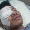 Azmar Buta Permanen, Kinerja Polres Bau Bau Dipertanyakan